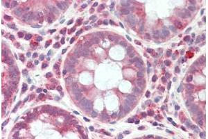 RPS6KC1 antibody  (AA 231-280)