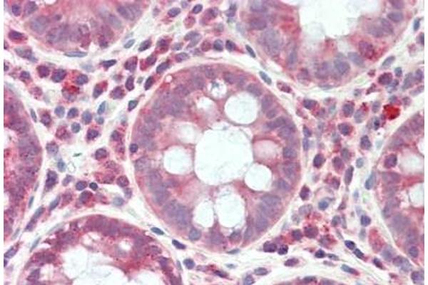 RPS6KC1 antibody  (AA 231-280)