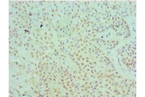 Immunohistochemistry (IHC) image for anti-serpin Peptidase Inhibitor, Clade B (Ovalbumin), Member 5 (SERPINB5) (AA 21-189) antibody (ABIN7169345)