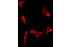 ABIN6272275 staining HeLa by IF/ICC. (CMTM4 antibody  (N-Term))
