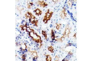 Immunohistochemistry of paraffin-embedded rat kidney using P Glycoprotein Rabbit mAb (ABIN7265732) at dilution of 1:100 (40x lens). (ABCB1 antibody)