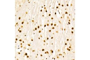 Immunohistochemistry (IHC) image for anti-K(lysine) Acetyltransferase 2A (KAT2A) (AA 1-100) antibody (ABIN1679964)