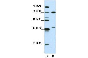 WB Suggested Anti-HNRPL  Antibody Titration: 0. (HNRNPL antibody  (N-Term))