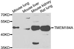 Western blot analysis of extracts of various cells, using TMEM184A antibody. (TMEM184A antibody)