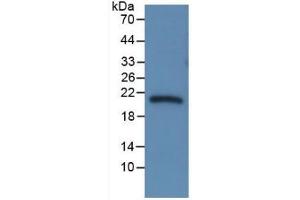 WB of Protein Standard: different control antibodies  against Highly purified E. (SERPINA6 ELISA Kit)