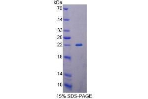 SDS-PAGE (SDS) image for Glutaryl-CoA Dehydrogenase (GCDH) (AA 270-438) protein (His tag) (ABIN6239324) (GCDH Protein (AA 270-438) (His tag))