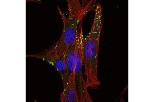 Immunofluorescence analysis of NIH/3T3 cells using KLHL1 mouse mAb (green). (KLHL1 antibody)
