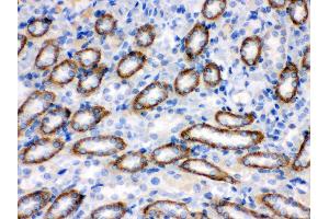 Anti- CYP1B1 Picoband antibody,IHC(P) IHC(P): Rat Kidney Tissue (CYP1B1 antibody  (AA 255-480))