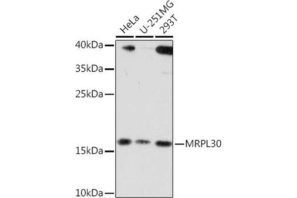 MRPL30 anticorps  (AA 1-161)