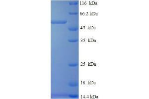 DHRS7 Protein (AA 29-339) (His-SUMO Tag)