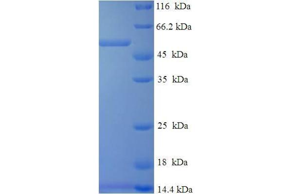 DHRS7 Protein (AA 29-339) (His-SUMO Tag)