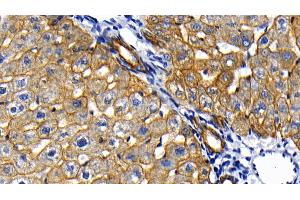 Immunohistochemistry (IHC) image for anti-Keratin 18 (KRT18) (AA 72-380) antibody (ABIN7433291)