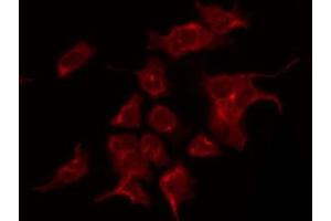ABIN6267490 staining K562 by IF/ICC. (VEGFR2/CD309 antibody  (pTyr1059))