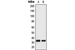 Western blot analysis of CDC2 (pY15) expression in HeLa UV-treated (A), A431 (B) whole cell lysates. (CDK1 antibody  (N-Term, pTyr15))