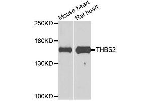 Western blot analysis of extracts of various cell lines, using THBS2 antibody (ABIN5996361) at 1/1000 dilution.