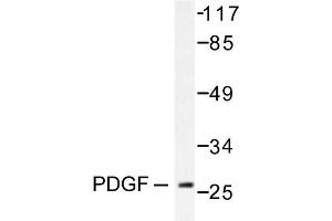 Image no. 1 for anti-Platelet Derived Growth Factor Subunit B (PDGFB) antibody (ABIN271781) (PDGFB antibody)