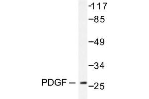 Image no. 1 for anti-Platelet Derived Growth Factor Subunit B (PDGFB) antibody (ABIN271781)