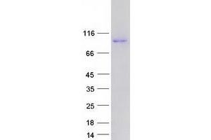 Validation with Western Blot (PNMAL2 Protein (Myc-DYKDDDDK Tag))