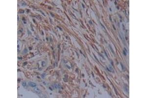 IHC-P analysis of Human Tissue, with DAB staining. (PDE4D antibody  (AA 581-809))