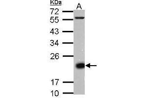 WB Image Sample (30 ug of whole cell lysate) A: Jurkat membrane 12% SDS PAGE antibody diluted at 1:10000 (CD3D antibody  (Center))