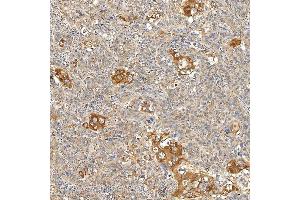 IHC analysis of SNPH using anti-SNPH antibody (ABIN7601724). (Syntaphilin antibody  (AA 43-482))