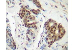 Image no. 1 for anti-Tumor Necrosis Factor alpha (TNF alpha) antibody (ABIN465605) (TNF alpha antibody)