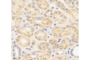 Immunohistochemistry analysis of paraffin-embedded human kidney using,MAP3K12 (ABIN7074679) at dilution of 1: 400