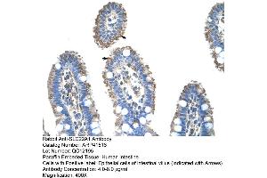 Rabbit Anti-SLC22A1 Antibody  Paraffin Embedded Tissue: Human Intestine Cellular Data: Epithelial cells of intestinal villas Antibody Concentration: 4. (SLC22A1 antibody  (N-Term))