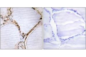 Immunohistochemistry (IHC) image for anti-BMX Non-Receptor Tyrosine Kinase (BMX) (AA 532-581) antibody (ABIN2888766)