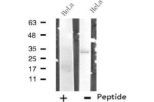 Western blot analysis of extracts from HeLa cells, using RNF144B antibody. (RNF144B antibody  (Internal Region))
