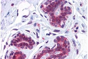 Human Breast: Formalin-Fixed, Paraffin-Embedded (FFPE) (CCDC106 antibody  (C-Term))
