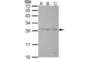 WB Image Sample (30 ug of whole cell lysate) A: Hela B: Hep G2 , C: Molt-4 , 12% SDS PAGE antibody diluted at 1:1000 (BAK1 antibody  (N-Term))