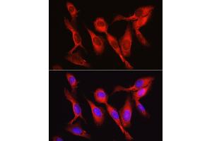 Immunofluorescence analysis of U2OS cells using Vinculin antibody (ABIN6128911, ABIN6150070, ABIN6150071 and ABIN6218474) at dilution of 1:150. (Vinculin antibody  (AA 767-1066))