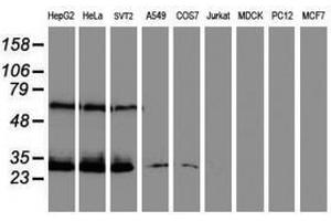 Image no. 2 for anti-Centromere Protein H (CENPH) antibody (ABIN1497470) (CENPH antibody)