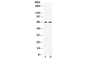Western blot testing of 1) rat testis and 2) human MCF7 lysate with CCDC6 antibody at 0.