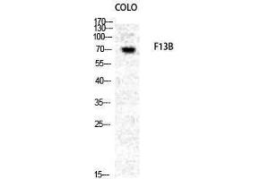Western Blotting (WB) image for anti-Coagulation Factor 13, B Polypeptide (F13B) (N-Term) antibody (ABIN3175044) (F13B antibody  (N-Term))