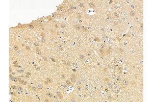 ABIN6255313 and ABIN6267193 at 1/100 staining Rat brain tissue by IHC-P. (tau antibody  (pSer416, pSer733))