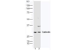 Lane1: Mouse kidney lysate, Lane2: Mouse brain lysate probed with Rabbit Anti-Calbindin Polyclonal Antibody, Unconjugated (ABIN2559729) at 1:300 in 4˚C. (CALB1 antibody  (AA 41-150))