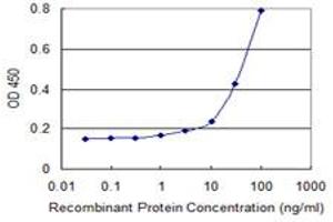 Detection limit for recombinant GST tagged ACP5 is 1 ng/ml as a capture antibody. (ACP5 antibody  (AA 72-158))