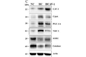 Western Blotting (WB) image for anti-Nuclear Respiratory Factor 1 (NRF1) antibody (ABIN2855569)