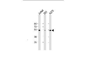 All lanes : Anti-RBCK1 (UBCE7IP3) Antibody at 1:2000 dilution Lane 1: Jurkat whole cell lysate Lane 2: 293 whole cell lysate Lane 3:  whole cell lysate Lysates/proteins at 20 μg per lane. (RBCK1 antibody)