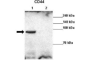 Lanes : Lane 1: 10ug MDA-MB-231 lysateLane 2: MDA-MB-231 + CD44 siRNA  Primary Antibody Dilution :  1:1000   Secondary Antibody : Goat anti rabbit-HRP  Secondary Antibody Dilution :  1:10,000  Gene Name : CD44  Submitted by : Chul Geun Kim and Dae Hyun Ha, Hanyang University. (CD44 antibody  (C-Term))