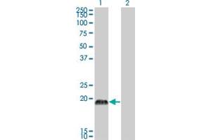 Western Blot analysis of CSRP3 expression in transfected 293T cell line by CSRP3 monoclonal antibody (M03), clone 6D2. (CSRP3 antibody  (AA 95-194))