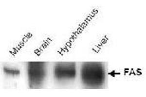 Western blot analysis of Fasn in tissue lysates (brain, hypothalmus, and liver and muscle) using Fasn polyclonal antibody . (Fatty Acid Synthase antibody)