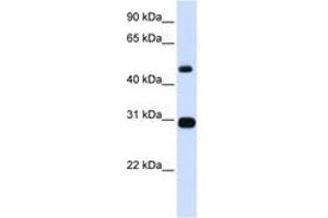 Image no. 1 for anti-Proteasome (Prosome, Macropain) 26S Subunit, ATPase, 3 (PSMC3) (AA 101-134) antibody (ABIN6741431)