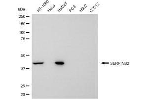Western blotting analysis using SERPINB2 antibody (ABIN7799846).