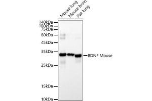 Western blot analysis of extracts of various cell lines, using BDNF Mouse mAb antibody (ABIN7265915) at 1:10440 dilution.