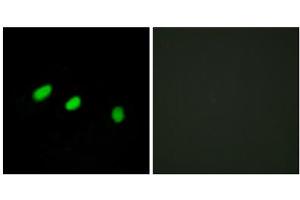 Immunofluorescence analysis of HeLa cells, using TRA-2 alpha antibody.