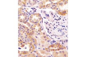 Antibody staining PCCA in human kidney tissue sections by Immunohistochemistry (IHC-P - paraformaldehyde-fixed, paraffin-embedded sections).