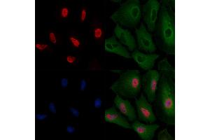 ABIN6257532 and ABIN6275728 staining  cells by IF/ICC. (THO Complex 4 antibody  (Internal Region))